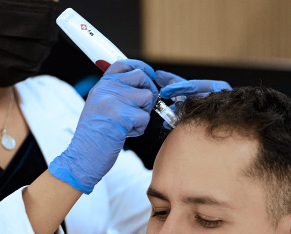 Dermapen Capilar Con Ampolletería